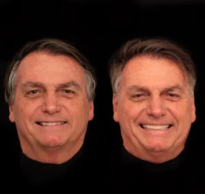 Bolsonaro realiza harmonização facial (foto: Reprodução)