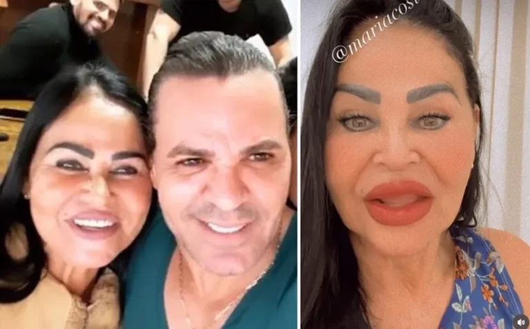 Mãe de Eduardo Costa nega harmonização facial (Foto: Instagram)