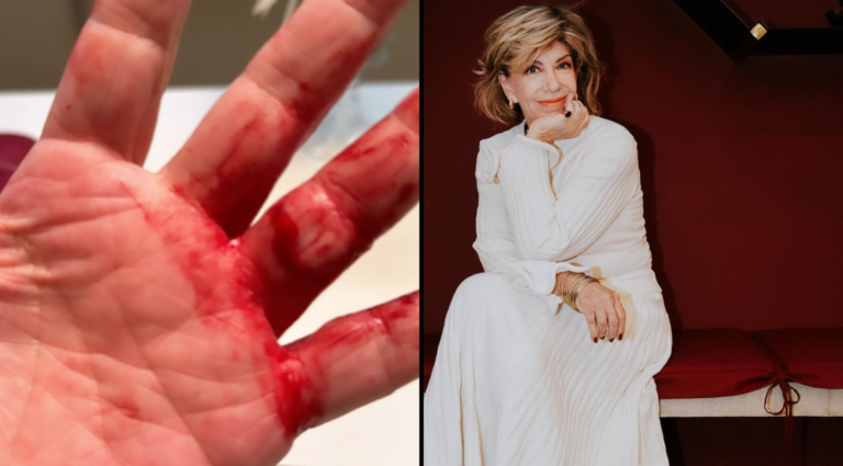 "Quase arrancaram minhas mãos", relata apresentadora Silvia Poppovic após assalto (imagens: Reprodução/ Redes Sociais)