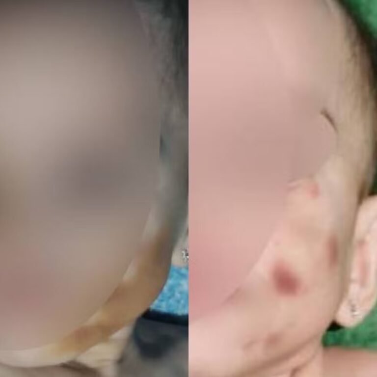 O bebê apresentava hematomas no rosto que estavam disfarçados por maquiagem (Foto: Reprodução)